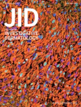 N6-methyladenosine RNA Methylation Correlates with Immune Microenvironment and Immunotherapy Response of Melanoma